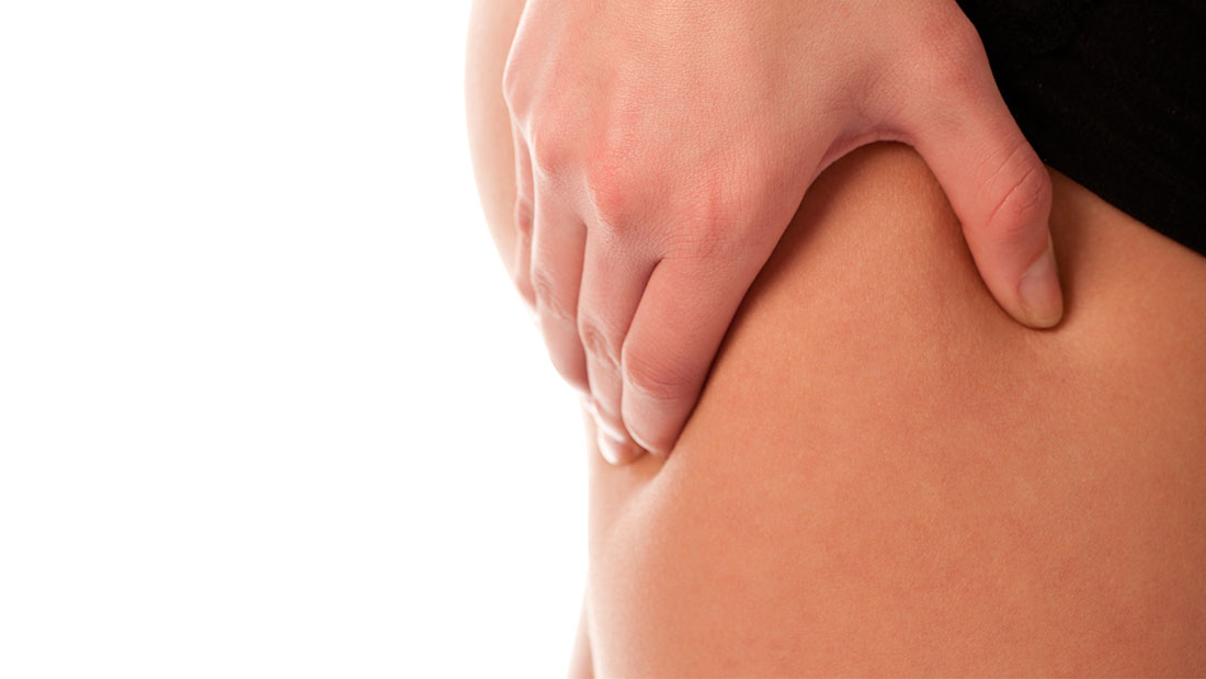 Tratamiento de la celulitis